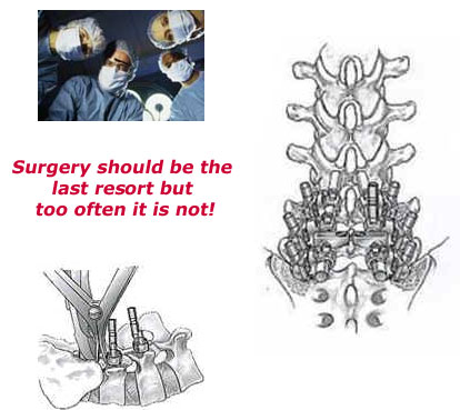 Surgeons and images of metal bolts used in back surgery
