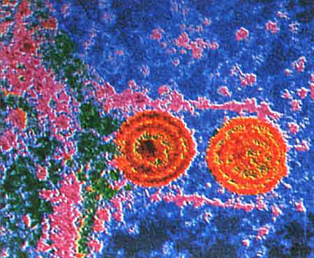Picture of the Herpes virus.